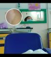 308准分子激光需要注意什么检查