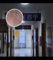 308光疗仪能照眼周吗